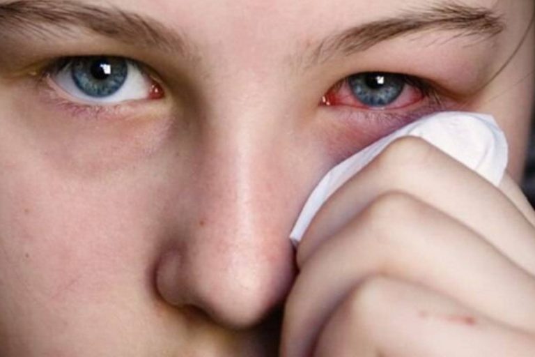 تفسير حلم العين المصابة