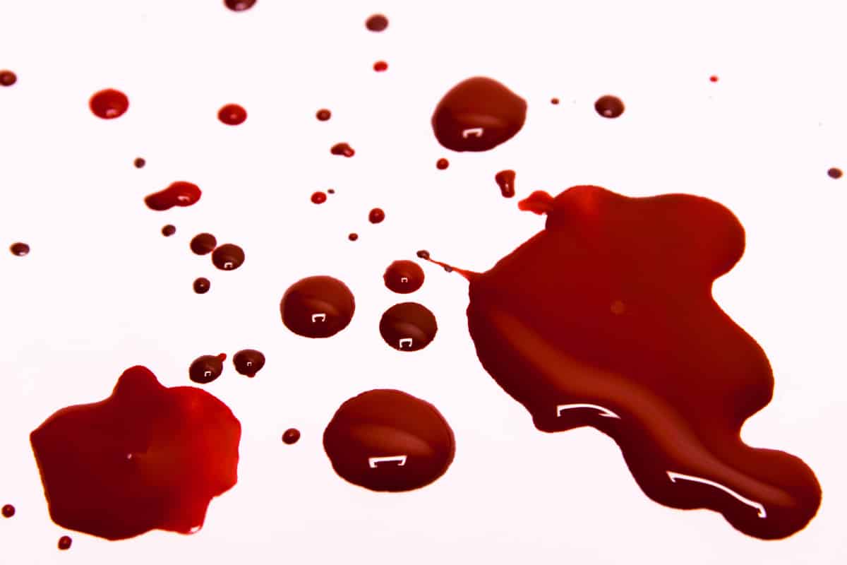  خروج قطع دم من الفرج للمتزوجه - تفسير الاحلام