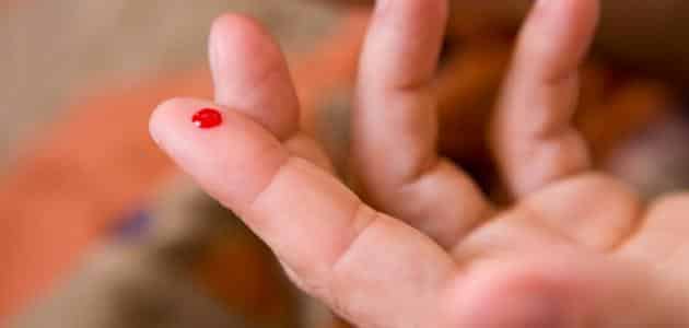 رؤية الدم في المنام يخرج من شخص اخر