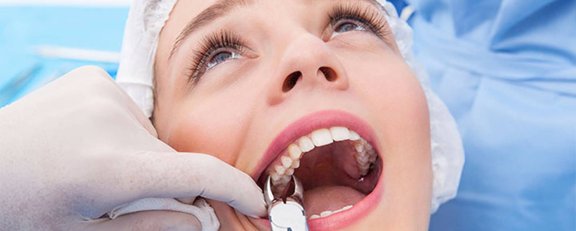 Visul extracției dentare
