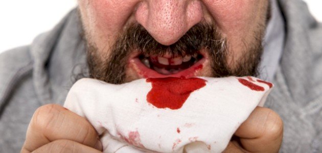  خروج الدم من الفم في المنام بالتفصيل - تفسير الاحلام
