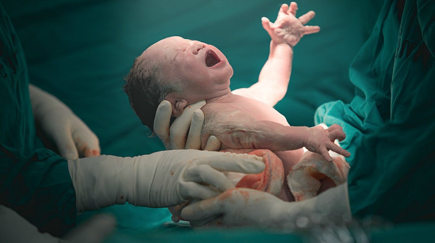 doctor nurse pulling new born baby vbac ss Feature 1440x806 1 - تفسير الاحلام