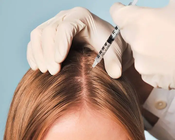 مين جربت حقن الميزوثيرابي للشعر