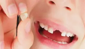 इब्न सिरिन द्वारा एक सपने में दांतों के नुकसान की सबसे महत्वपूर्ण 30 व्याख्या