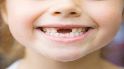 इब्न सिरिन द्वारा सपने में दांत गिरने की सबसे महत्वपूर्ण 20 व्याख्या