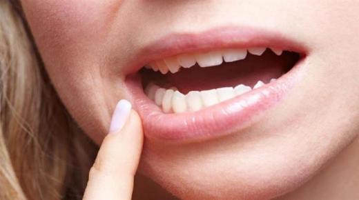 इब्न सिरीनशी विवाहित महिलेसाठी स्वप्नात दात पडण्याचे 20 सर्वात महत्वाचे स्पष्टीकरण