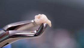 इब्न सिरीन, अल-नबुलसी आणि वरिष्ठ न्यायशास्त्रज्ञांनी स्वप्नात दात काढण्याचा अर्थ काय आहे?