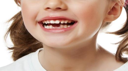 इब्न सिरिन द्वारा दांतों के झड़ने के सपने की सबसे महत्वपूर्ण 20 व्याख्या