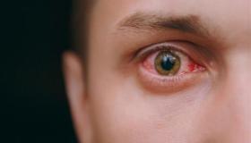 इब्न सिरीनने दुसऱ्या व्यक्तीच्या डोळ्यातून रक्त येण्याच्या स्वप्नाचा अर्थ लावला