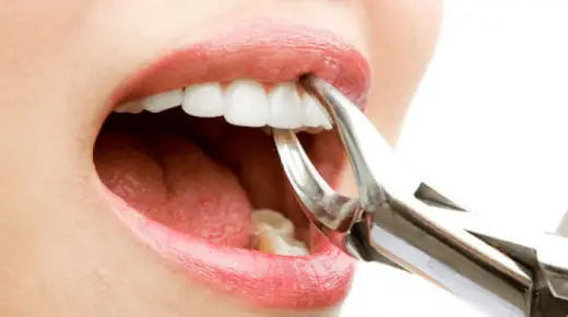 इब्न सिरिन द्वारा दांत निकालने के सपने की सबसे महत्वपूर्ण 20 व्याख्या