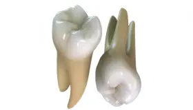 इब्न सिरिन के दांत गिरने के सपने की व्याख्या जानें