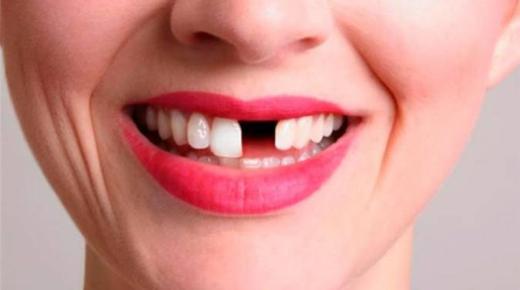 इब्न सिरिन के अनुसार, एक महिला के केवल एक दांत के गिरने के सपने की व्याख्या क्या है?