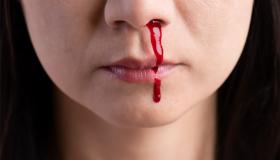 इब्न सिरिन द्वारा सपने में नाक से खून बहने के 7 संकेत, जानिए विस्तार से