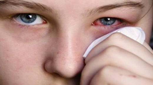 इब्न सिरीनच्या जखमी डोळ्याच्या स्वप्नाचा अर्थ काय आहे?