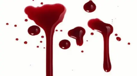 Kakvo je tumačenje sna o obilnoj menstrualnoj krvi za Ibn Sirina?