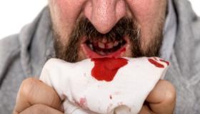 ما تفسير خروج الدم من الفم في المنام لابن سيرين؟