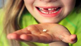 इब्न सिरिन के अनुसार दांतों के बारे में एक सपने की सबसे महत्वपूर्ण 20 व्याख्या